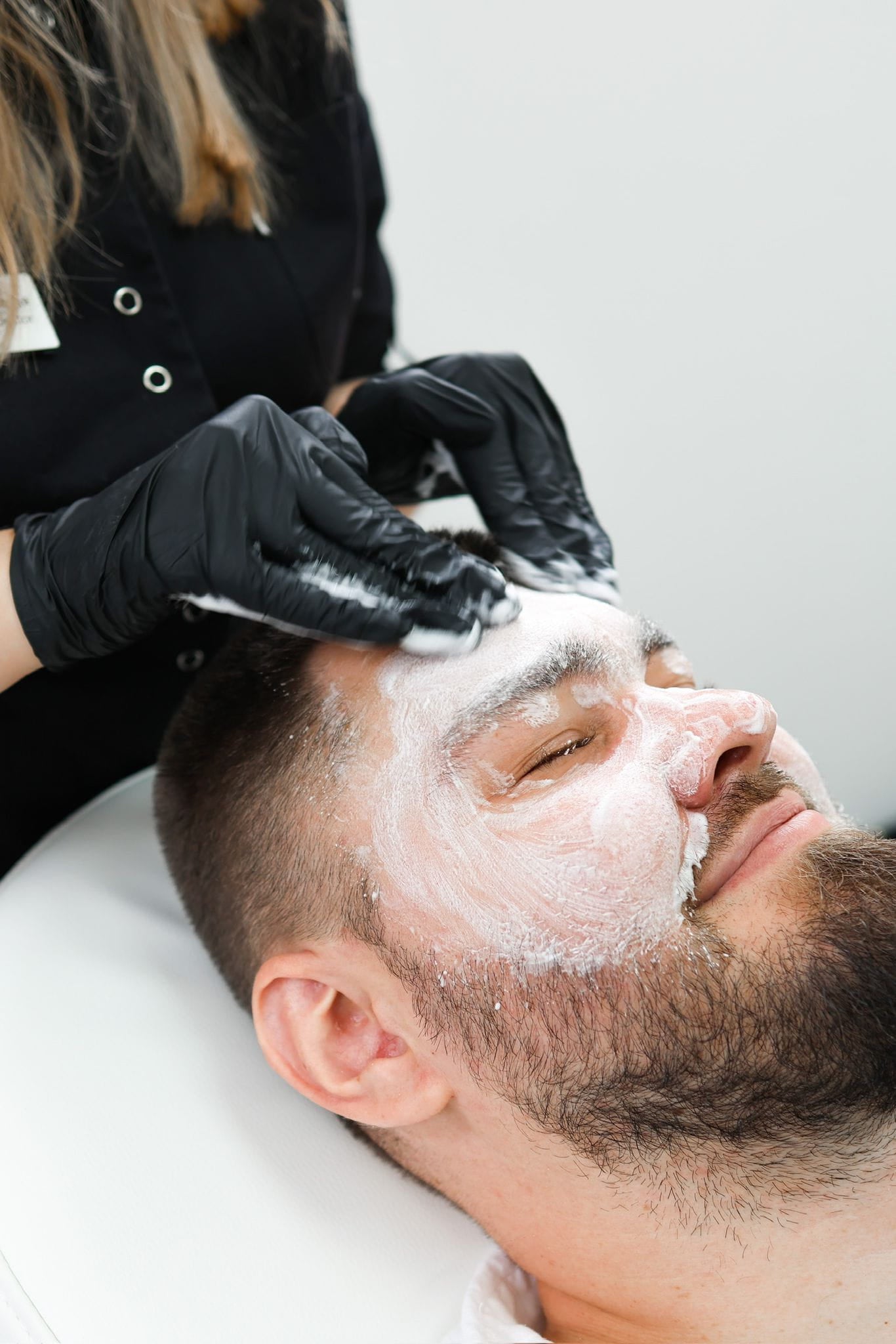 How Obagi Nu-Derm Skin System works for melasma in Kingston Upon Thames Surrey London